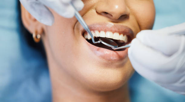 Best Emergency Dental Care for Abscessed Tooth in Myrtle Grove, NC